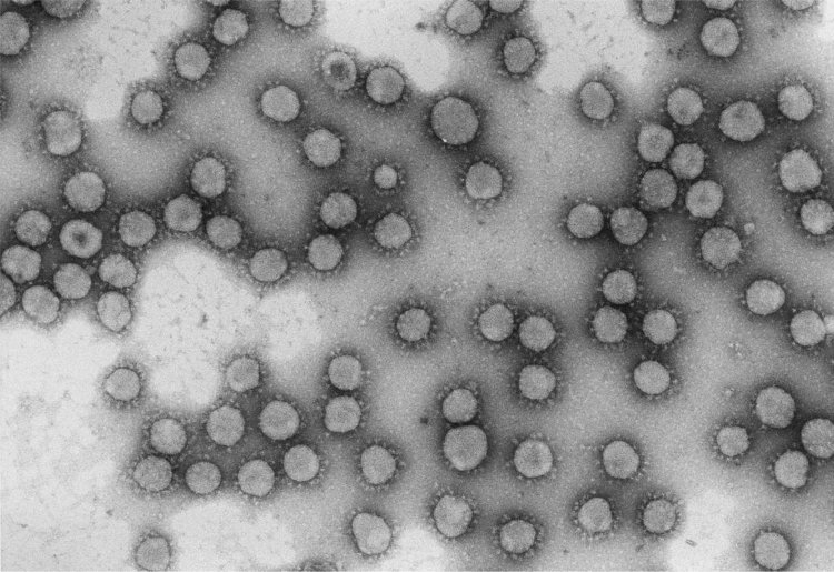Purified coronavirus. An illustration from CNB-CSIC. MADRID. Acad. Luis Enjuanes.