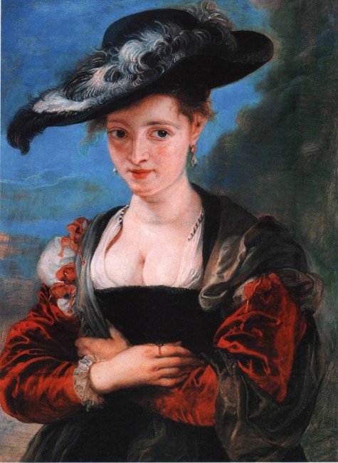 The painting "The Straw Hat" by the famous Flemish painter Peter Paul Rubens depicts a woman with typical signs of Graves' disease