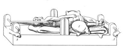Hippocratic Bench. Correction of hip dislocation. 1 – injured limb; 2 – roller; 3 – reels moving in the opposite direction