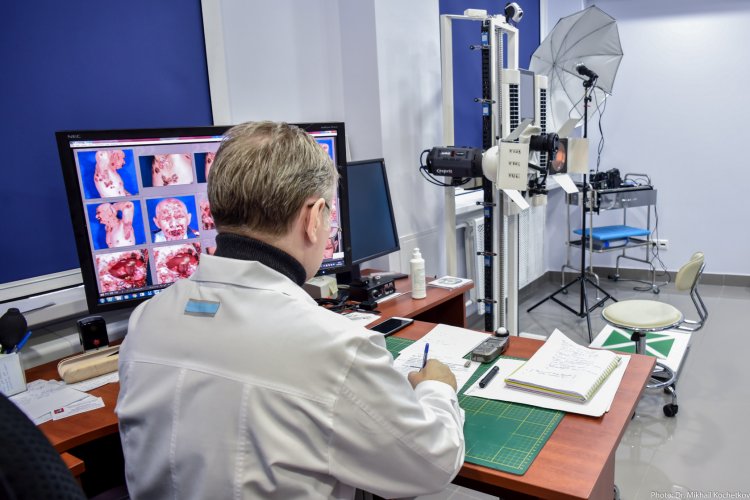 Candidate of Medical Sciences Kochetkov M.A. in the laboratory of the MSPCDC Center for Noninvasive Skin Diagnostics